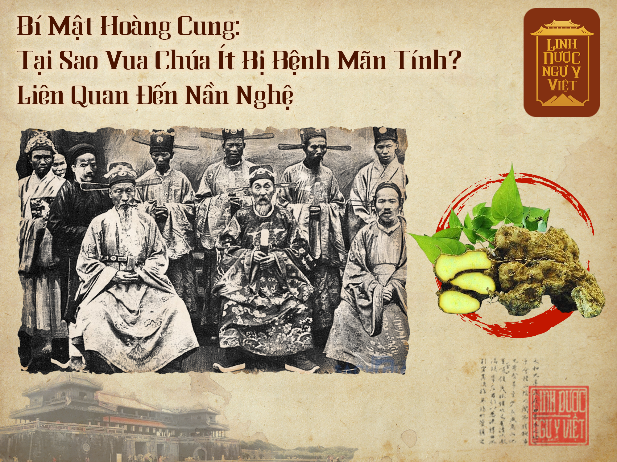 Bí Mật Hoàng Cung: Tại Sao Vua Chúa Ít Bị Bệnh Mãn Tính? Liên Quan Đến Nần Nghệ